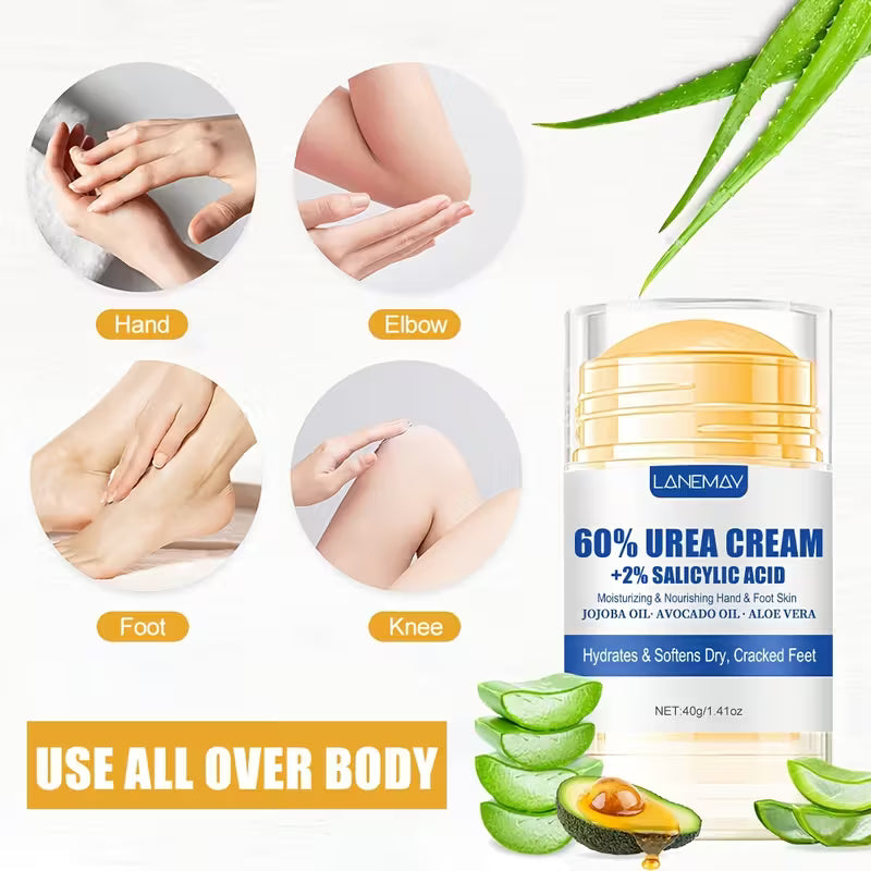 Intense Callus Remover with 2% Salicylic Acid Urea Foot Cream.