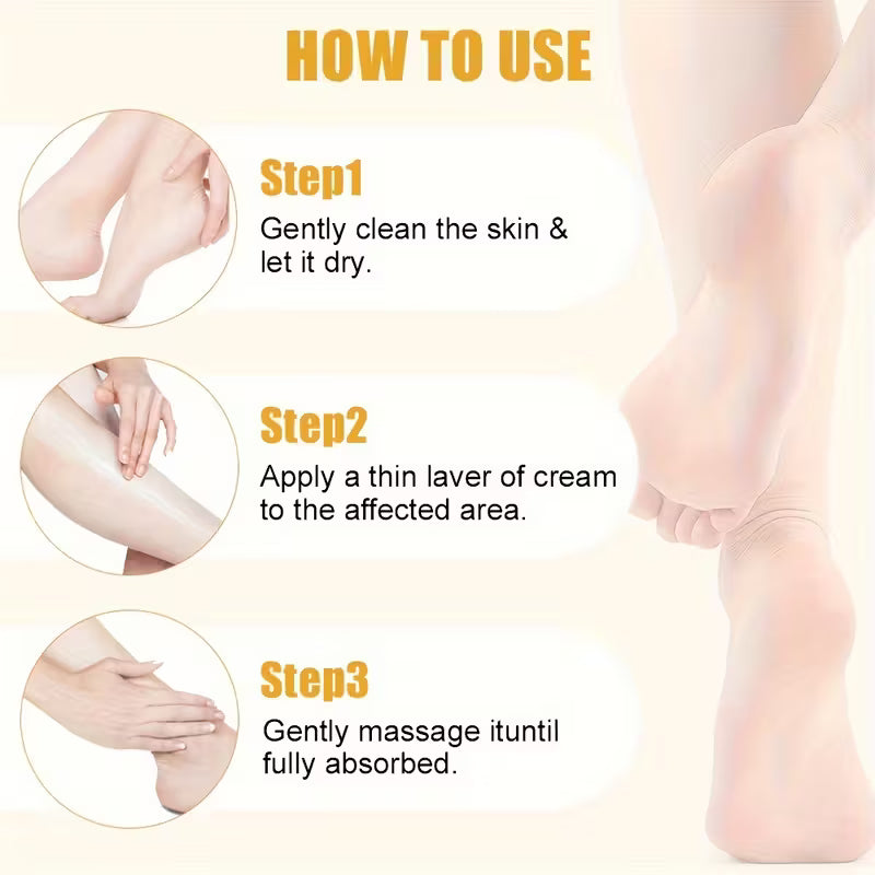 Intense Callus Remover with 2% Salicylic Acid Urea Foot Cream.
