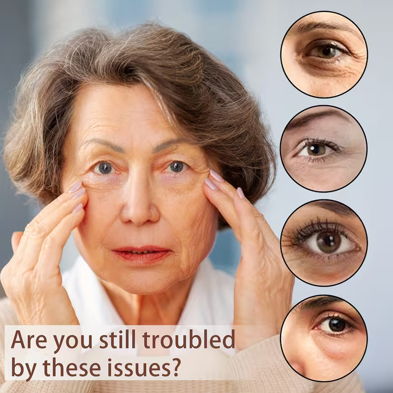 Treatment for Puffy Eyes & Dark Circles Instant Lift Retinol Eye Cream.